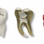 Ein 3D-gedruckter Zahn, der alles kann: Das UKW setzt neue Maßstäbe – praxisnah, wissenschaftlich fundiert und zukunftsorientiert