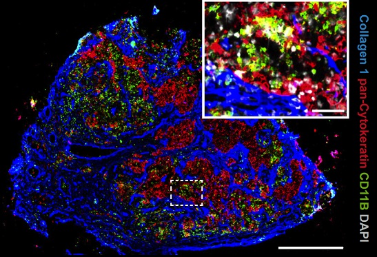 Die Korruption im Lymphknoten unterbinden: Angela Riedel erforscht mit ihrer Arbeitsgruppe am Mildred-Scheel-Nachwuchszentrum
