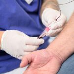 Jeder Dritte, der sich einem größeren chirurgischen Eingriff unterzieht, leidet unter Blutarmut