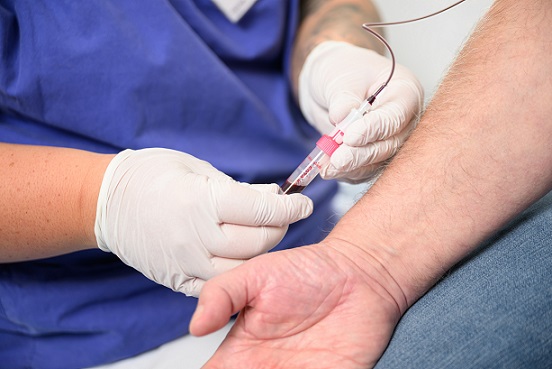 Jeder Dritte, der sich einem größeren chirurgischen Eingriff unterzieht, leidet unter Blutarmut