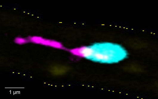 „PITTs“ verändern das Verständnis der Thrombozytenbiologie: Würzburger Forscher entdecken neuartige Entzündungsfunktion von Blutplättchen