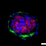 Um Tierversuche zu reduzieren: SET-Stiftung fördert Würzburger Entwicklung eines pathophysiologischen 3D-Modells der menschlichen Bindehaut