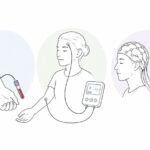 Das Uniklinikum Würzburg sucht Männer mit Migräne und gesunde Frauen ohne für eine Studie