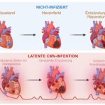 Ein Herpesvirus, das die meisten von uns in sich tragen, kann die Erholung des Herzens nach einem Infarkt beeinträchtigen