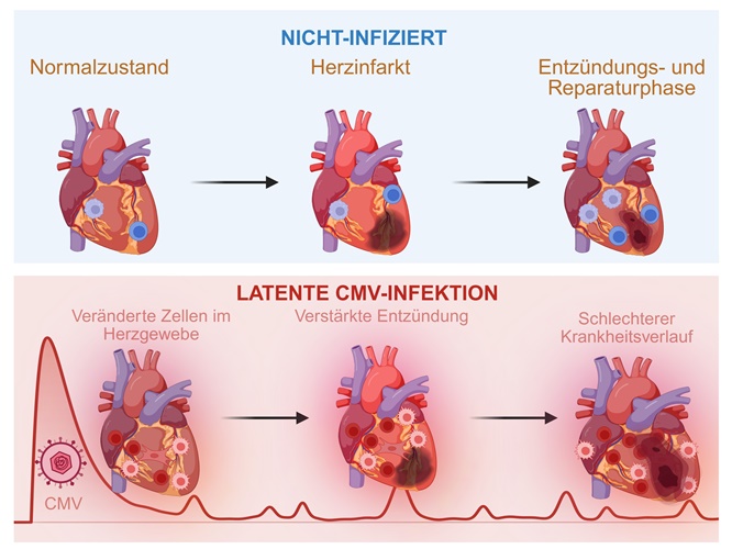 Ein Herpesvirus, das die meisten von uns in sich tragen, kann die Erholung des Herzens nach einem Infarkt beeinträchtigen